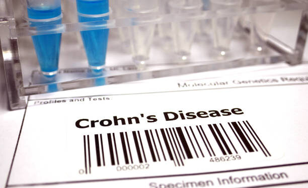 Crohnova choroba: neviditeľný nepriateľ